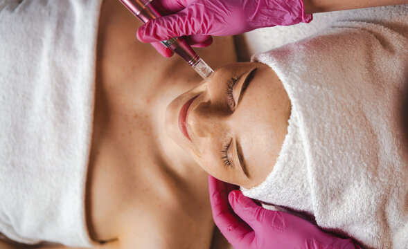 Woman getting a facial dermapen treatment at spa salon. Beauty concept. Face cosmetic procedure. Cosmetology. Skin Lift Procedure.