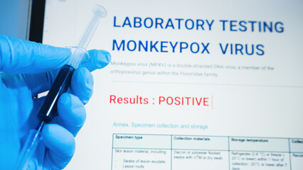 Monkeypox concept, syringe with blood and display screen. Documented positive experimental results.