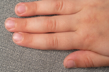 Child's dirty and sloppily cut nails, fingers and toenails close-up.