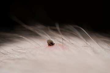 Teak with its chelicerae adhering to human skin.