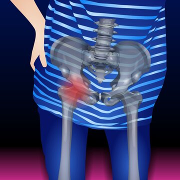 Human Urinary System Consists Of The Kidneys, Renal Pelvis, Ureter, Urinary Bladder, Urethra And Parts Of Skeleton. Renal System And Bones Of The Hip