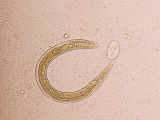 Strongyloides stercoralis or threadworm in human stool, analyze by microscope, original...
