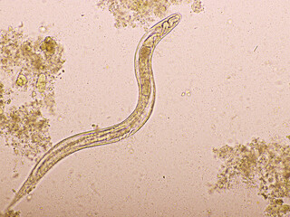 Strongyloides stercoralis or threadworm in human stool, analyze by microscope, original magnification 400x