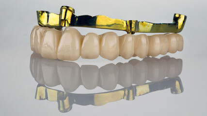 dental prosthesis of the upper jaw from zircon and a bar of gold color on top on white glass with reflection © Dental Pro Content