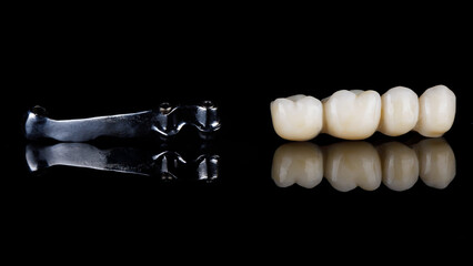 dental bridge prosthesis for four teeth and a special bar made of titanium on a black background with reflection