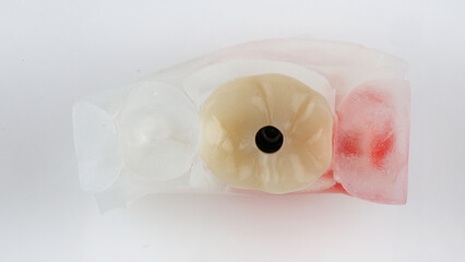 top view of a zircon dental crown on a model with a white background