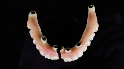 broken temporary dental prosthesis of the upper jaw from a polymer on a black background, top view © Dental Pro Content