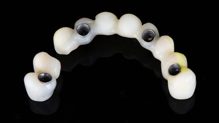 breakdown of the dental prosthesis of the upper jaw into two parts on a black background, top view © Dental Pro Content