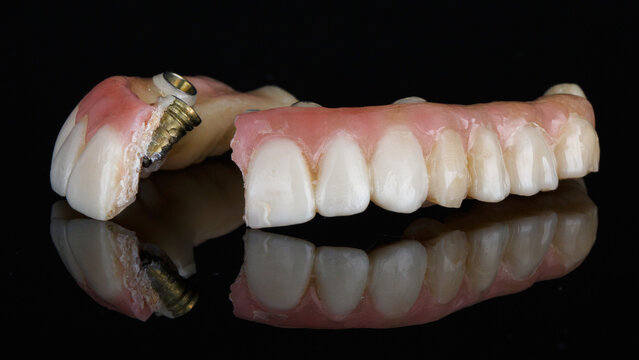 breakage of a temporary dental prosthesis of the upper jaw made of polymer on black glass with reflection