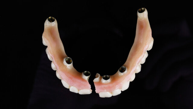 broken temporary dental prosthesis of the upper jaw from a polymer on a black background, top view