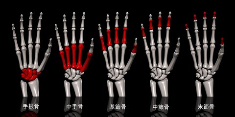 手部骨部位一覧