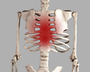 Skeleton with red point at breastbone. Chest and ribs pain. Costochondritis. Health problems,...