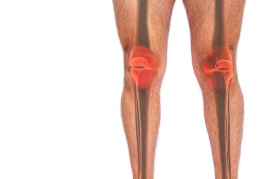 Transparent image of femur, fibula and tibia bones of a man suffering from joint pain on white isolated background