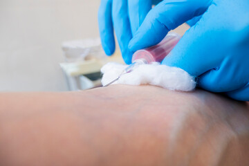 Close up blood test from vein