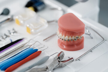 Tooth model with metal braces lying on a dental table with instruments - obrazy, fototapety, plakaty