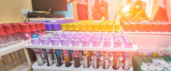 The laboratory assistant prepares blood for analysis for antibodies and viruses.