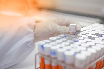 Scientist hand with a tube of blood sample and a rack with other samples. Lab technician holding blood tube sample for study. Conceptual image coronavirus (COVID-19) test tube sample.