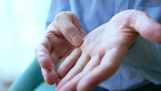Allergy male hands with allergies, peeling on the hands. Very dry, chapped skin on the palms, problematic skin, dermatological treatment needed.