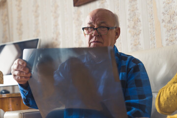Fototapeta premium Concerned, shocked and confused old caucasian grey-haired man looking at his lungs x-ray results and worrying about his diagnosis while sitting on a beige leather sofa at home. High quality photo