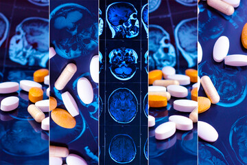 Different pharmaceutical medicine pills on magnetic brain resonance scan mri background collage....