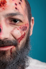 Halloween zombie having bloody wounds and scars on half of face, looking aggressive and evil in...