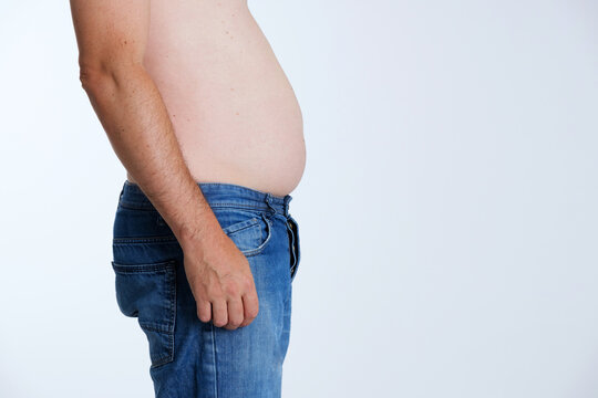 Anonymous Man With A Swollen Belly. Slimming Diet