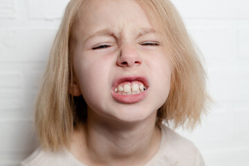Girl shows teeth with a gap, malocclusion