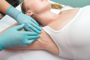 Depilation and epilation of the female armpit with liquid sugar paste. The beautician's hand applies wax paste to the armpit.