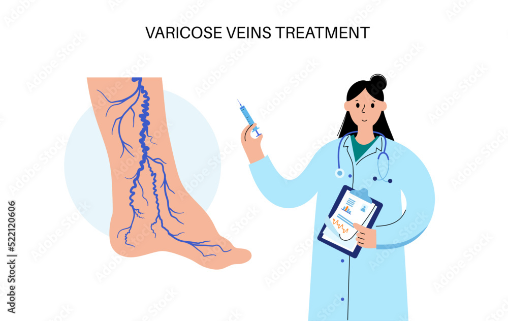 Sticker Varicose veins treatment