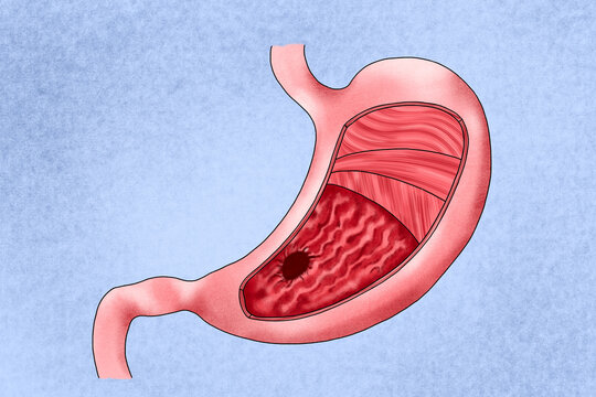 Human stomach
