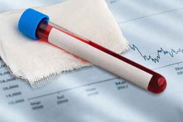 Blood tube for test detection of Virus Covid-19 Omicron BA.5 Variant with papers document.
