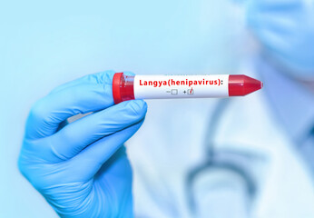 Doctor holding a test blood sample tube with positive Langya henipavirus (LayV).The virus is transmitted from animals to humans. Infected people suffer from fever, cough, headache, nausea and vomiting