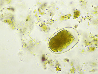 Egg of Hookworm in human stool, analyze by microscope, original magnification 400x