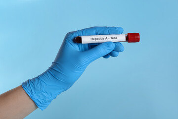 Obraz premium Scientist holding tube with blood sample and label Hepatitis A Test on light blue background, closeup