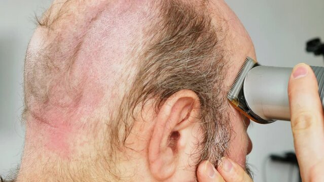 Man shaves his head. Amateur haircut in the bathroom. An overgrown man with a bald patch clumsily cuts his brown gray hair on his head with an electric clipper. Self shaving head with a trimmer 