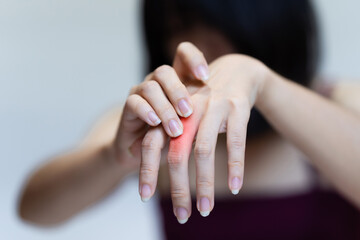 Woman's knuckle pain, Signs of osteoarthritis.