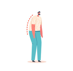 Man with Bent Spine and Head Tilt. Male Character Wrong Standing Position, Bad Back Posture. Spinal Health Curvature
