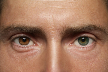 Man with beautiful eyes of different colors, closeup. Heterochromia iridis