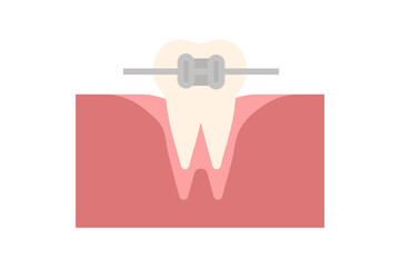 Vector Orthodontics. Tooth with metal braces and bracket system. Dental icon. Web pictogram for dentistry. Stomatology concept, logo or illustration. Orthodontist orthopedist specialization emblem.