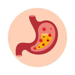 The stomach is filled with bacteria and ulcers.