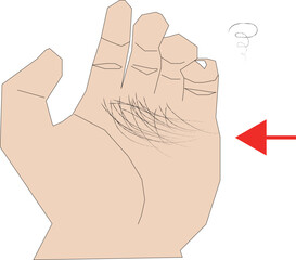 手の上に抜け毛のイラスト