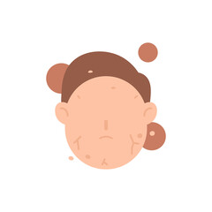 Fototapeta premium Xerosis, a dry and peeling skin condition. the skin on the face is scaly and dry. lack of moisture in the skin and lack of water content. health. flat cartoon illustration. vector concept design