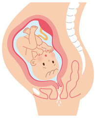 前期破水　子宮の中の赤ちゃん　妊娠中の母体の仕組み - obrazy, fototapety, plakaty
