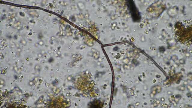 soil microbes organisms in a soil and compost sample, fungus and fungi and under the microscope in regenerative agriculture. in australia.
