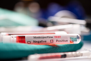 Monkey pox test tube on medical desk, monkeypox virus diagnosis concept