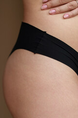 body skin with strechmarks, normalizing body flaws, accepting yourself and being confident in your...