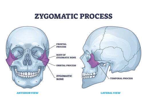 Zygomatic process as human cheek bone skeleton anatomy outline diagram. Labeled educational cheekbone location and skull parts structure vector illustration. Frontal, orbital and temporal process.