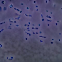 Biofilm of antibiotic resistant bacteria, closeup view. Rod-shaped and spherical bacteria. Escherichia coli, Pseudomonas aeruginosa, Mycobacterium tuberculosis, Klebsiella, Staphylococcus aureus