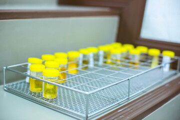 Selective focus to many urine sample bottle,