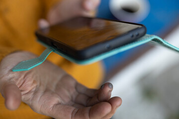 Taking a Photograph with Phone of Broken Injured Finger